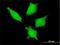 DEAD-Box Helicase 20 antibody, H00011218-M01, Novus Biologicals, Immunocytochemistry image 