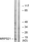 Mitochondrial Ribosomal Protein S21 antibody, LS-C120081, Lifespan Biosciences, Western Blot image 
