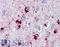 Crystallin Alpha B antibody, LS-B3696, Lifespan Biosciences, Immunohistochemistry paraffin image 