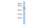 Transmembrane Protein 161B antibody, GTX45605, GeneTex, Western Blot image 