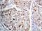 Mitogen-Activated Protein Kinase Kinase 1 antibody, PA1376, Boster Biological Technology, Immunohistochemistry frozen image 