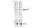 ALK Receptor Tyrosine Kinase antibody, 3348S, Cell Signaling Technology, Western Blot image 