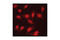 Protein Phosphatase 2 Scaffold Subunit Aalpha antibody, 2039S, Cell Signaling Technology, Immunocytochemistry image 
