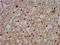 Solute Carrier Family 12 Member 5 antibody, LS-C674043, Lifespan Biosciences, Immunohistochemistry paraffin image 