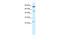 Chloride Voltage-Gated Channel 6 antibody, 28-281, ProSci, Enzyme Linked Immunosorbent Assay image 