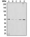 AKT Serine/Threonine Kinase 2 antibody, orb213546, Biorbyt, Western Blot image 