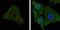 B-Raf Proto-Oncogene, Serine/Threonine Kinase antibody, NBP1-47433, Novus Biologicals, Immunohistochemistry paraffin image 