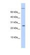 AT-Rich Interaction Domain 5A antibody, NBP1-79452, Novus Biologicals, Western Blot image 