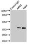 Arginase 2 antibody, LS-C375254, Lifespan Biosciences, Immunoprecipitation image 