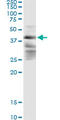Zinc finger FYVE domain-containing protein 19 antibody, LS-C139515, Lifespan Biosciences, Immunoprecipitation image 