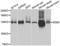 Damage Specific DNA Binding Protein 1 antibody, abx002127, Abbexa, Western Blot image 