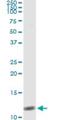 Natriuretic Peptide B antibody, H00004879-M01, Novus Biologicals, Immunoprecipitation image 