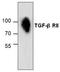 Transforming Growth Factor Beta Receptor 2 antibody, GTX59893, GeneTex, Western Blot image 