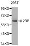 Interleukin 2 Receptor Subunit Beta antibody, abx004743, Abbexa, Western Blot image 