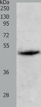 Pepsin A antibody, TA323322, Origene, Western Blot image 