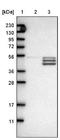 Solute Carrier Family 25 Member 25 antibody, NBP1-82886, Novus Biologicals, Western Blot image 