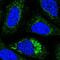 NADH:Ubiquinone Oxidoreductase Subunit C1 antibody, PA5-60747, Invitrogen Antibodies, Immunofluorescence image 