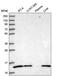 ATPase H+ Transporting V1 Subunit G1 antibody, PA5-65342, Invitrogen Antibodies, Western Blot image 