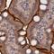 Transmembrane Channel Like 5 antibody, NBP1-83697, Novus Biologicals, Immunohistochemistry paraffin image 