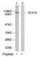 Signal Transducer And Activator Of Transcription 6 antibody, AP02591PU-S, Origene, Western Blot image 