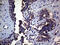 Milk Fat Globule-EGF Factor 8 Protein antibody, M02518-1, Boster Biological Technology, Immunohistochemistry paraffin image 