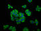 Sodium Voltage-Gated Channel Alpha Subunit 11 antibody, LS-C673733, Lifespan Biosciences, Immunofluorescence image 