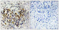 Iroquois-class homeodomain protein IRX-3 antibody, abx013556, Abbexa, Western Blot image 