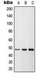 TNF Receptor Superfamily Member 10b antibody, LS-C353813, Lifespan Biosciences, Western Blot image 