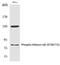 SRBP1 antibody, PA5-40276, Invitrogen Antibodies, Western Blot image 