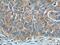 Cereblon antibody, 66336-1-Ig, Proteintech Group, Immunohistochemistry paraffin image 