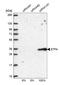 Electron Transfer Flavoprotein Subunit Alpha antibody, NBP1-84854, Novus Biologicals, Western Blot image 