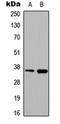 N-Ethylmaleimide Sensitive Factor, Vesicle Fusing ATPase antibody, orb373013, Biorbyt, Western Blot image 