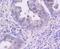 Cyclin Dependent Kinase 4 antibody, NBP2-67736, Novus Biologicals, Immunohistochemistry paraffin image 