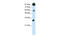 CCCTC-Binding Factor antibody, ARP38820_P050, Aviva Systems Biology, Western Blot image 