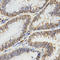 Tropomyosin 2 antibody, A03082, Boster Biological Technology, Immunohistochemistry frozen image 