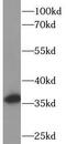PCNA antibody, FNab06217, FineTest, Western Blot image 