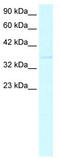 Caudal Type Homeobox 4 antibody, TA331153, Origene, Western Blot image 