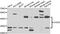 DHHB-MTase antibody, A08851, Boster Biological Technology, Western Blot image 