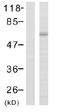 LIM domain kinase 2 antibody, ab38499, Abcam, Western Blot image 