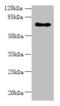Zinc Finger Protein 133 antibody, CSB-PA026532LA01HU, Cusabio, Western Blot image 