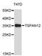 Tetraspanin 12 antibody, STJ26731, St John