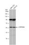 Cytochrome P450 Family 17 Subfamily A Member 1 antibody, NBP2-16077, Novus Biologicals, Western Blot image 