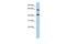 Mitochondrial Calcium Uptake Family Member 3 antibody, A17694, Boster Biological Technology, Western Blot image 