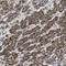 N-Terminal Xaa-Pro-Lys N-Methyltransferase 1 antibody, NBP1-89255, Novus Biologicals, Immunohistochemistry paraffin image 