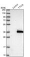 Tetratricopeptide Repeat Domain 33 antibody, NBP1-82469, Novus Biologicals, Western Blot image 