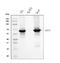Keratin 5 antibody, M00398-7, Boster Biological Technology, Western Blot image 