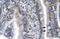 Lymphoid Enhancer Binding Factor 1 antibody, GTX17431, GeneTex, Immunohistochemistry paraffin image 