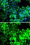 SARS antibody, GTX64795, GeneTex, Immunofluorescence image 