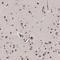 Tumor Protein P53 Inducible Nuclear Protein 1 antibody, NBP1-85108, Novus Biologicals, Immunohistochemistry frozen image 