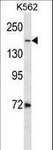 DNA Topoisomerase II Alpha antibody, LS-C160115, Lifespan Biosciences, Western Blot image 